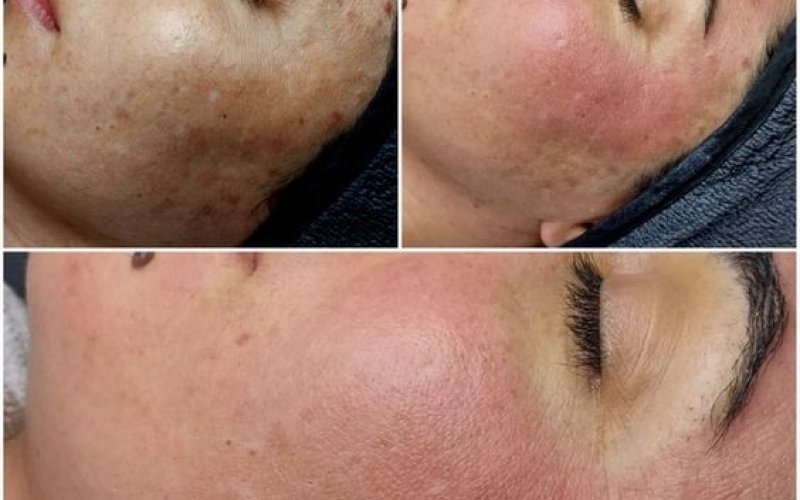 Cilt Sorunları İçin Profesyonel Çözümler